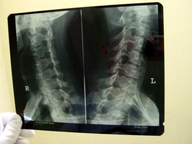 rentgen kręgosłupa
