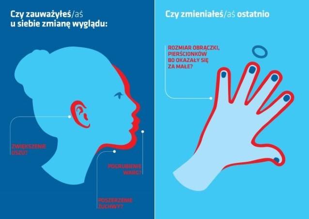 Objawy akromegalii - dwie grafiki: po lewej Czy zauważyłeś/aś u siebie zmianę wyglądu: powiększenie uszu, pogrubienie warg, poszerzenie żuchwy. Po lewej grafika: Czy zmieniałeś/aś ostatnio rozmiar obrączki, pierścionków, bo okazały się za małe?